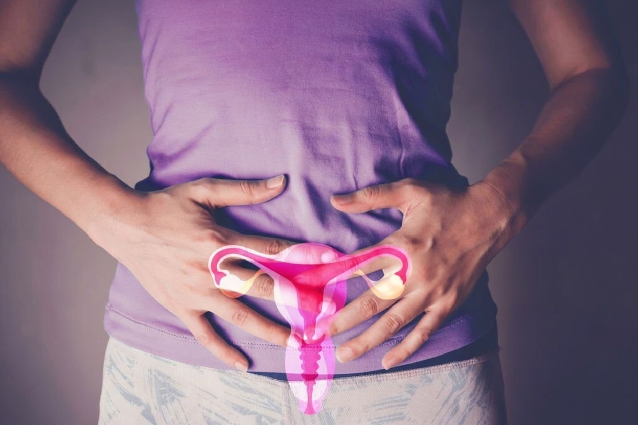 Le cancer des ovaires : une tumeur redoutable